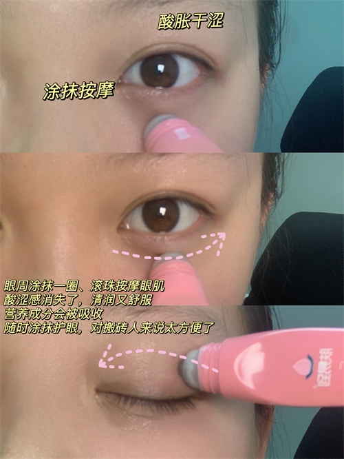 近视眼和美瞳眼的救星，缓解眼疲劳绝了