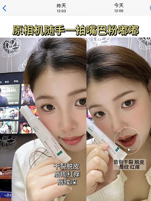亲测有效！唇部救星快速维稳修护唇肌