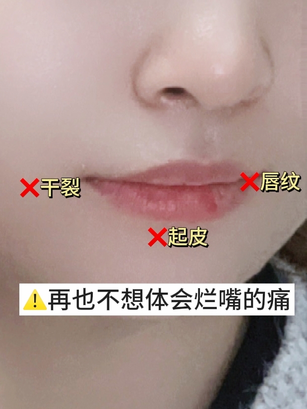 亲测有效！唇部救星快速维稳修护唇肌